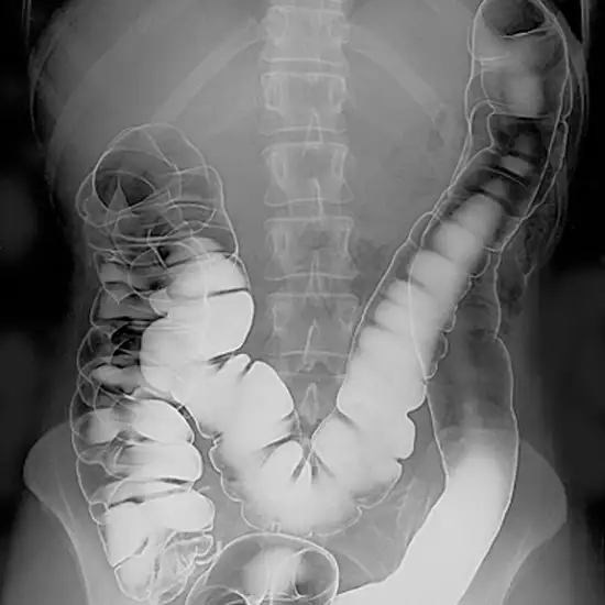 MRI Abdominal Double Contrast Only